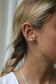 Arete estrella